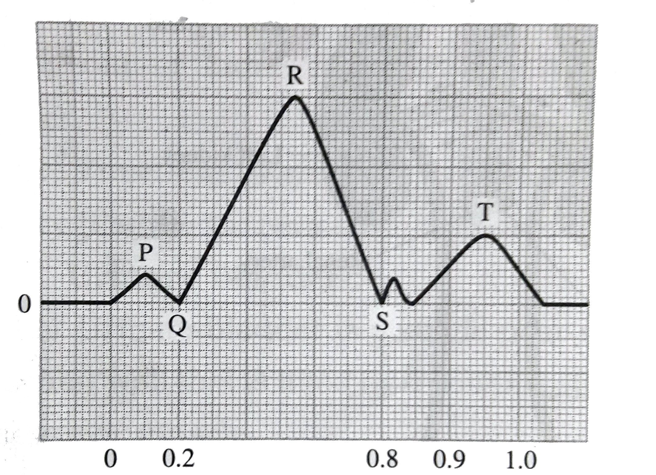 Look at the diagram  and answer the  following questions :       Which electrical activity  does QRS wave represent  ?