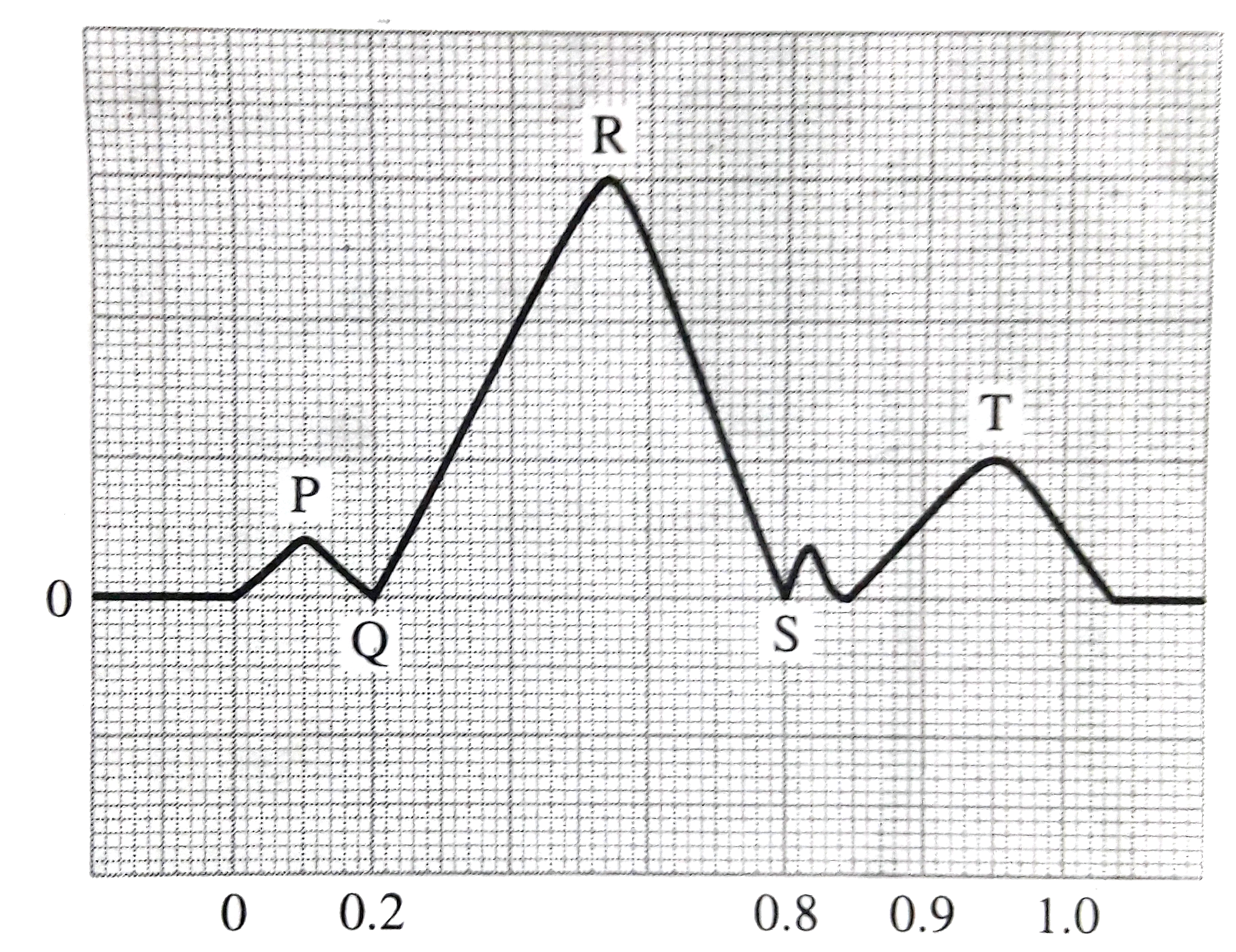 Look at the diagram  and answer the  following questions :        From which part of the heart does QRS signal initiate ?