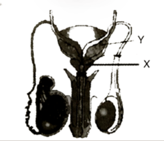 identify X and Y in the diagram related to human reproductive system. Choose the correct option:-