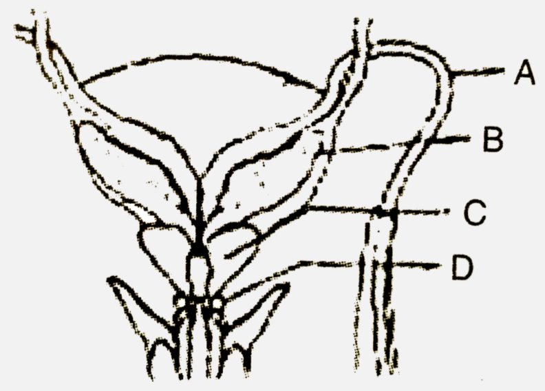 Given below is a diagrammatic sketch of a portion ofhuman male reproductive system. Select the correct set of the names of the parts labelled A,B,C,D:-