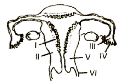 The figure given below depists a diagramatic sectional view of the female reproduction system f humans. Which one set of three parts out of I-VI have been correctly identified?