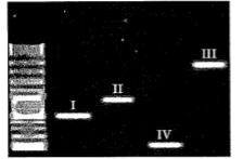 The image below depicts the result of gel electrophoresis          If the ladder represents sequence length upto 3000 base pairs (bp),    Explain the basis of this kind of separation and also mention the significance of this process.