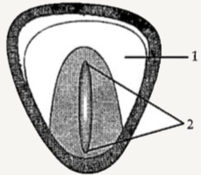 Study the diagram given below and answer the questions that follow:       Name the food material stored in this  structure.