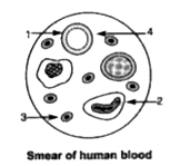 Given below is a diagram of a human blood smear. Study the diagram and answer the questons that follow:      Mention two structural differences between the parts '1' and 2.