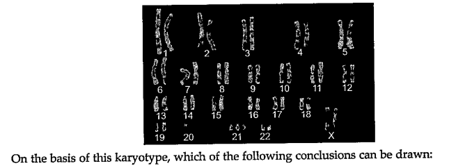 Placed below is a karyotype of a human being.