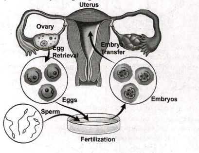 Artificial insemination means: