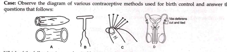 B prevents pregnancy by preventing :