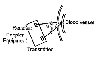 In the field of medical diagnosis ultrasound waves are used with Doppler's effect to find the nature of problems in the blood vessels. The ultrasound sent is received after reflection and the properties are analysed using electrical impulses generated from there. If there is any shift in the reflector then the frequency received will differ from the frequency of the incident wave. The doppler shift (in frequency ) is given by   Delta=((2v