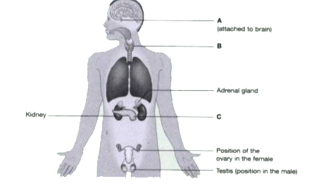 Hormones play a vital role in regulating the growth, development, behavioral development and reproduction . Our body produces about 30 hormones that remain active in our body. Kindly check the diagram and try to answer the questions below :      Name the disease which is caused due to lack of iodine in the body.