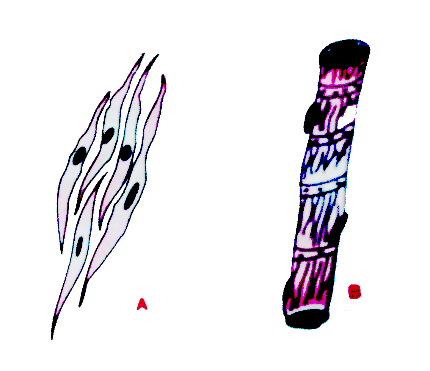 (a) Two slides were observed under the microscope for spot test as shown below. Given the correct identification of the two spots.      (b) Give one characteristic feature of each spot.