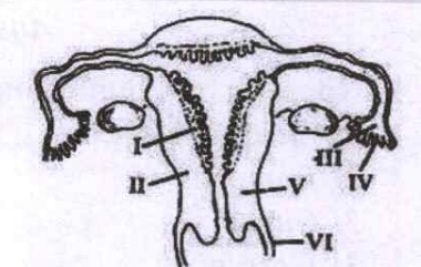 The figure given below depicts a diagrammatic sectional view of the female reproductive system of humans. Which one set of three parts out of I-VI have been correctly identified?