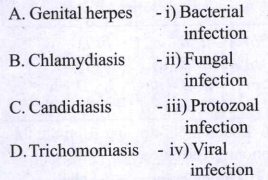 Match the following with correct options