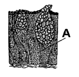 Given below is a diagrammatic representation of a glandular tissue    Idientify the structure labelled as 'A' and choose the correct option w.r.t. its its example.