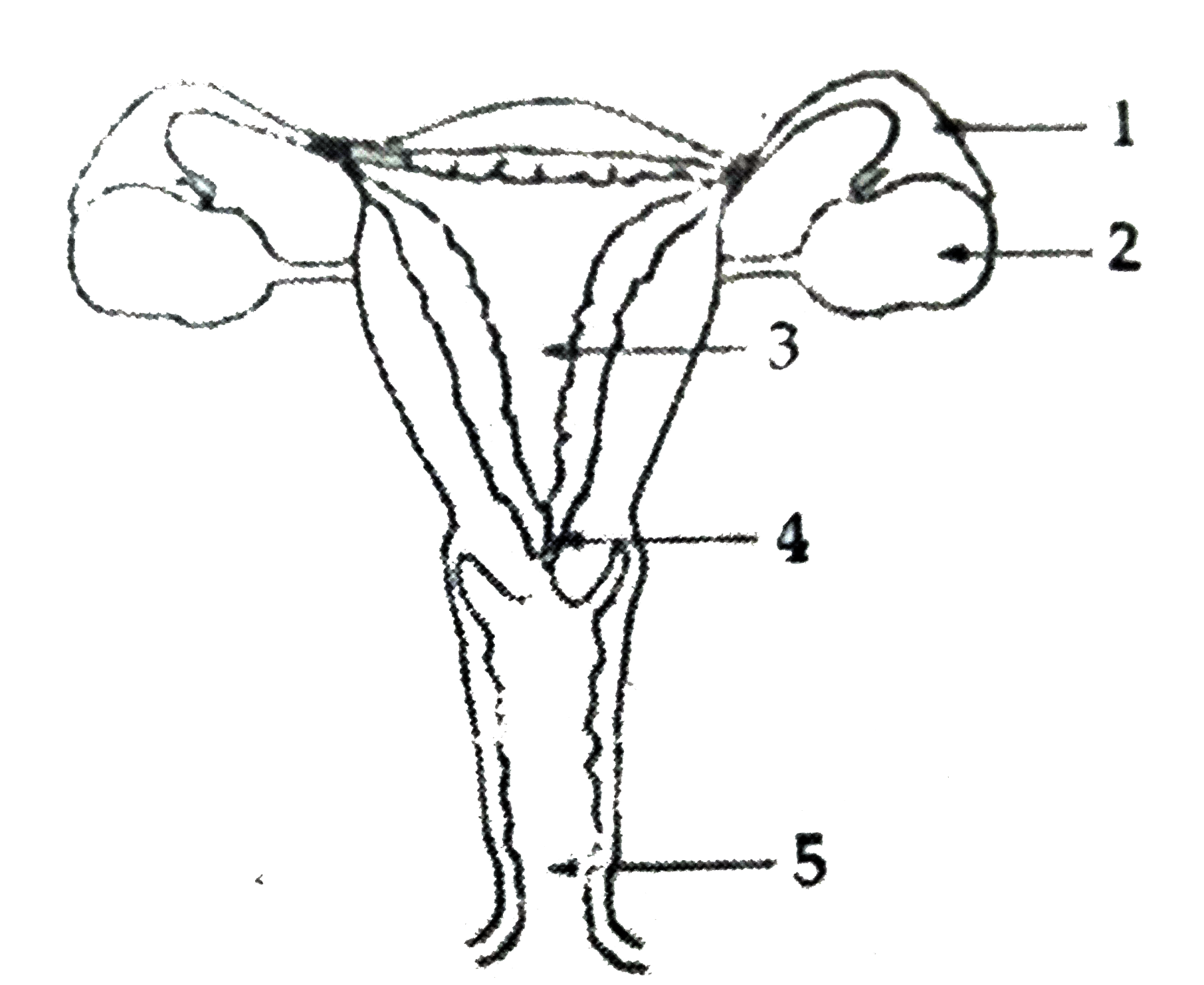 (a) Identify the diagram. Name the parts 1 to 5.           (b) What is contraception? List three advantages of adopting contraceptive measures.