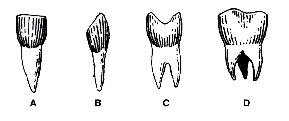 Identify and name the four types of teeth shown below and state their functions.
