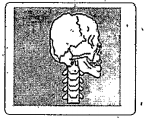 Identify the joint from picture given.