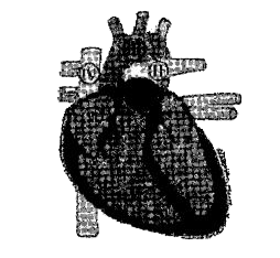 The given figure shows the human heart.      The portion of the heart. Labeled I is known as