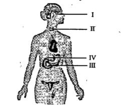 The given illustration represents the human endocrine glands.Name I, II, III, IV