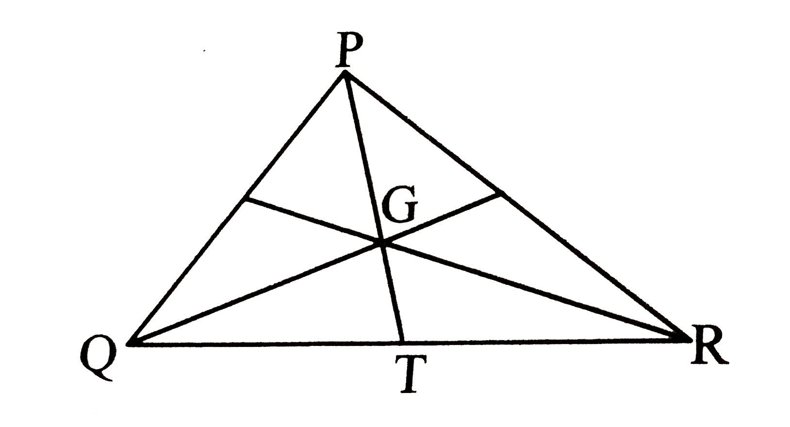 In the given figure point G is the pointof concurrence of the medians of  DeltaPQR . If GT = 2.5,  then find the length of PG.