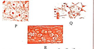 Question based on diagram  Identify the types of connective tissues (P,Q and R) shown below: