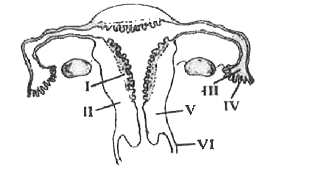 नीचे दिये जा रहे चित्र में मानवों के मादा जनन-तंत्र का एक आरेखीय काट दृश्य दिखाया गया है। इसमें I से VI में से कौन-से तीन भागों के समूह को ठीक से पहचाना गया है