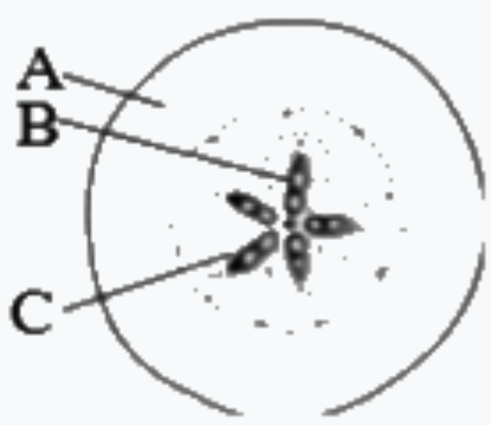 Identify the given figure with correct labelling :