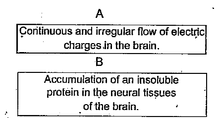 Symptoms of two diseases that effect human nervous system are given below. a) Identify the diseases A and B b) Write one cause of each disease.