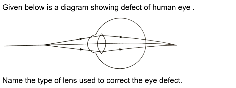 What Are The Type Of Eye Defects?