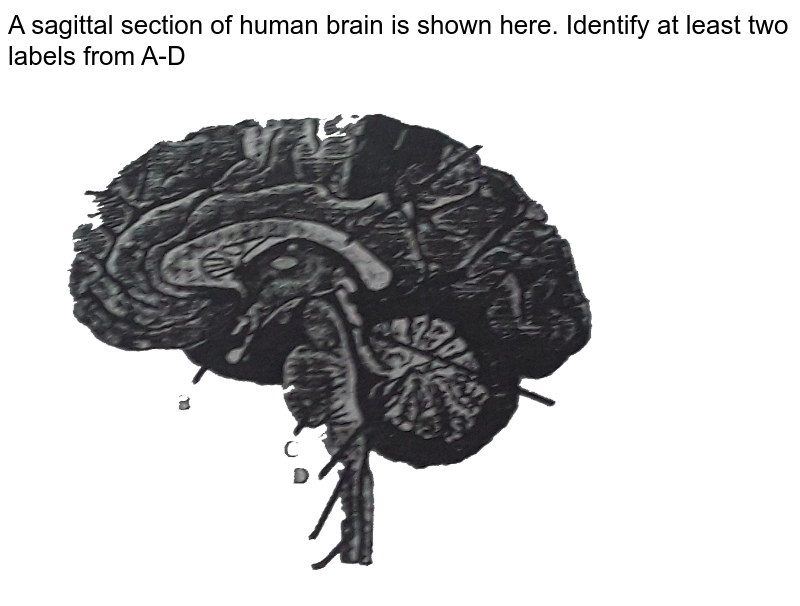 human brain mapping labels