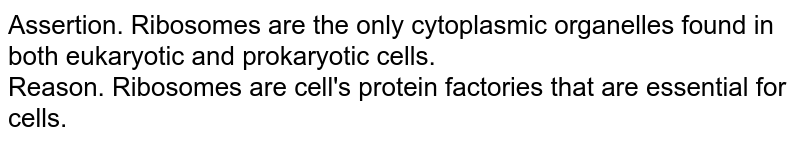 What Is True Statement Regarding Ribosomes� What Is True Statemen What Is True Statement Regarding Ribosomes� What Is True Statemen