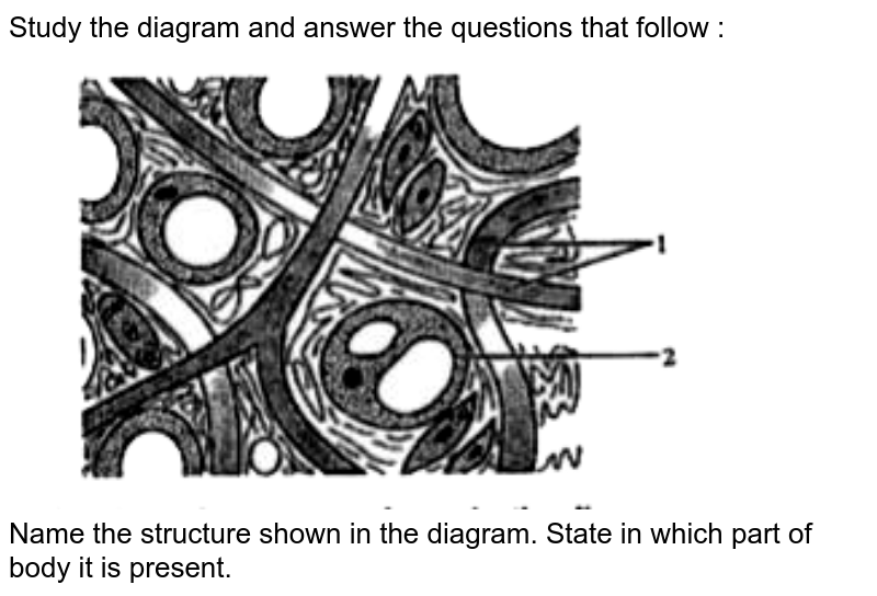 Study the diagram and answer the questions that follow : <br> <img src="https://doubtnut-static.s.llnwi.net/static/physics_images/OSW_ICSE_QB_BIO_IX_C12_E01_025_Q01.png" width="80%"> <br>  Name the structure shown in the diagram. State in which part of body it is present. 