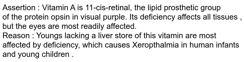 Assertion : Vitamin A is 11-cis-retinal, the lipid  prosthetic group<br> of the protein opsin in visual purple. Its deficiency  affects  all tissues , but the eyes are most readily affected.  <br> Reason : Youngs lacking  a liver store of this vitamin are most <br>affected  by deficiency, which  causes Xeropthalmia in human infants  and young  children . 