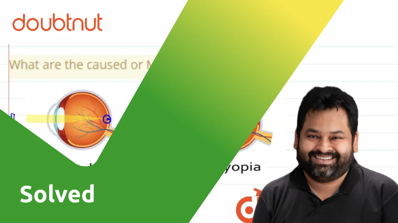  Tamil What Are The Caused Or Myopia