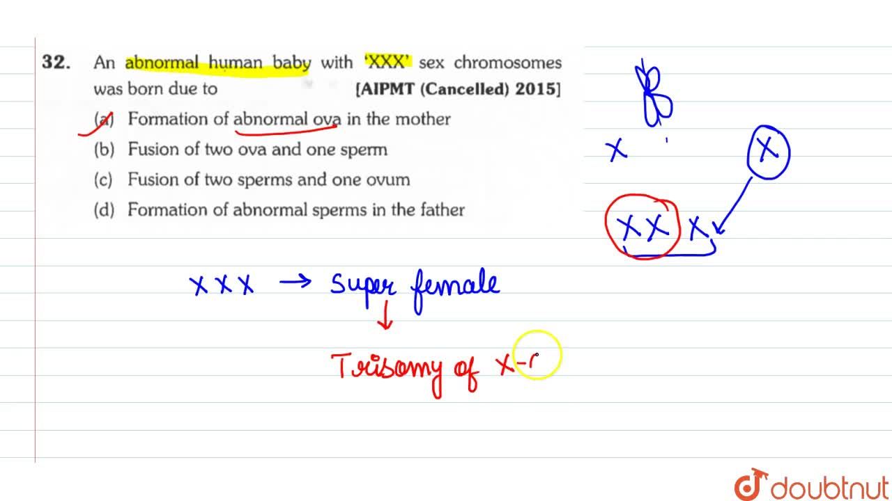 An abnormal human baby with `XXX` sex chromosomes was born due to